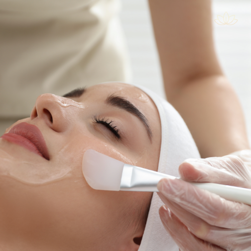 Chemical Peel